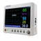 Ηλεκτροκαρδιογράφημα/NIBP φορητός πολλαπλών παραμέτρων για την αποθήκευση εσωτερικών δεδομένων στο νοσοκομείο