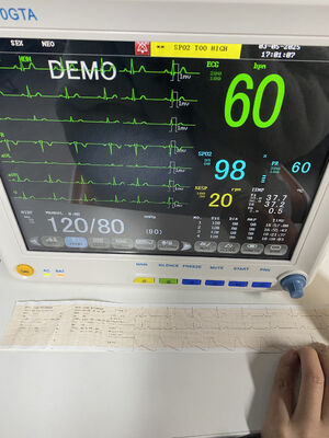 Φορητό κομοδίνο με ECG SPO2 NIBP TEMP RESP Προαιρετικό ETCO2-Class II Εγγύηση 1 έτους